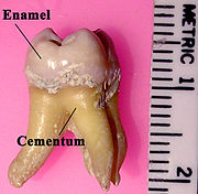 Labeledmolar.jpg